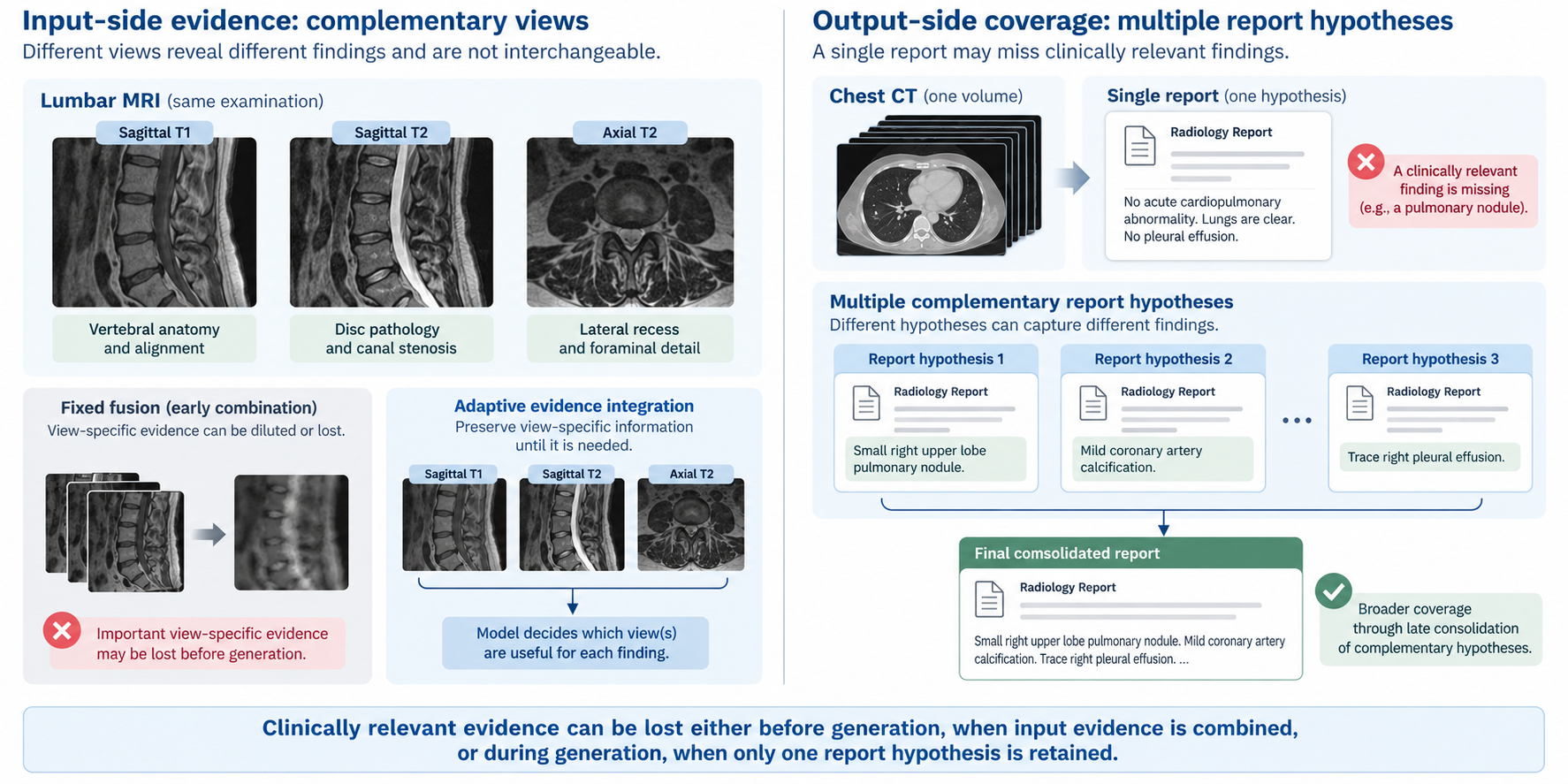 Input-side evidence loss when complementary imaging views are combined, and output-side coverage loss when only one report hypothesis is retained.